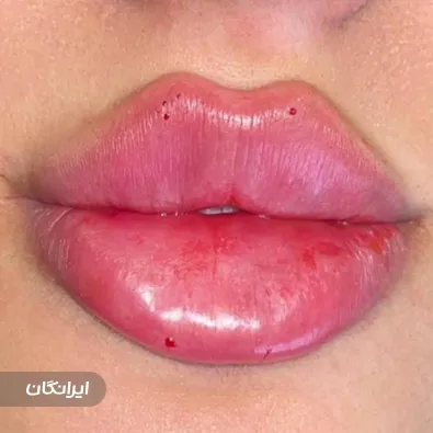 کلینیک زیبایی لیلیوم