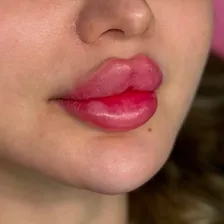 کلینیک زیبایی لیلیوم