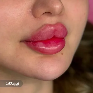 کلینیک زیبایی لیلیوم