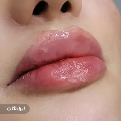 کلینیک زیبایی شونا