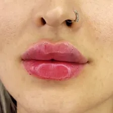 کلینیک زیبایی شونا