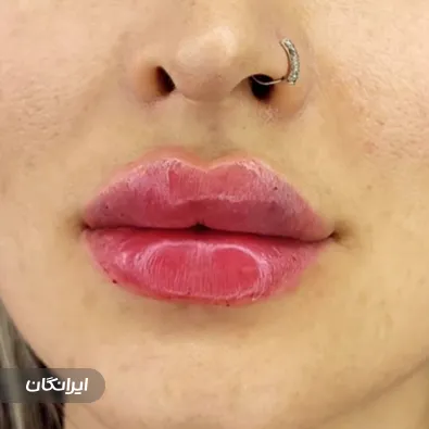 کلینیک زیبایی شونا