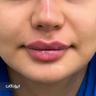 کلینیک زیبایی باران بیوتی