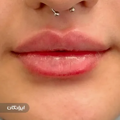 کلینیک زیبایی باران بیوتی