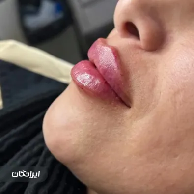 کلینیک زیبایی مهتا