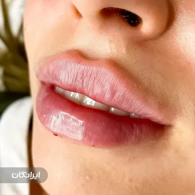 کلینیک زیبایی مهتا