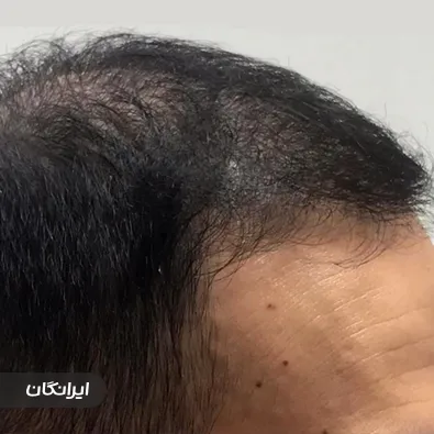 کلینیک زیبایی دکتر فریدون بهینا