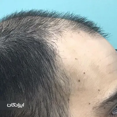 کلینیک زیبایی دکتر فریدون بهینا