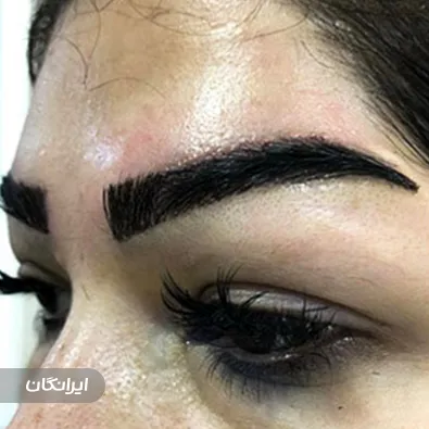 کلینیک زیبایی آدنیس کاشت