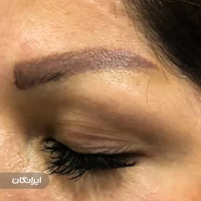 کلینیک زیبایی آدنیس کاشت