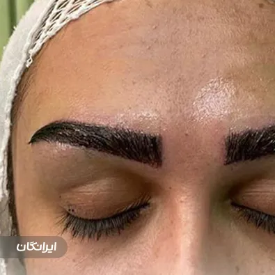 کلینیک زیبایی آدنیس کاشت