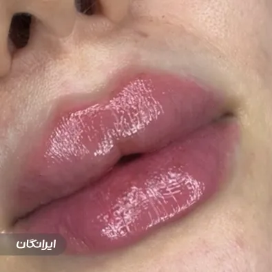 کلینیک زیبایی میلا