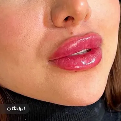 کلینیک زیبایی نگار