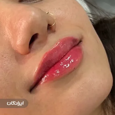 کلینیک زیبایی دکتر نگین عزیزاله