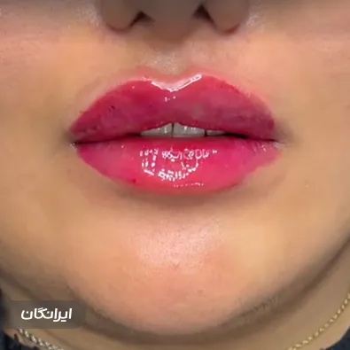 کلینیک زیبایی دکتر زهره ابراهیمی