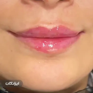 کلینیک زیبایی دکتر زهره ابراهیمی