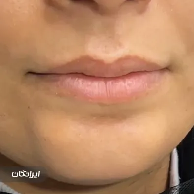 کلینیک زیبایی دکتر زهره ابراهیمی