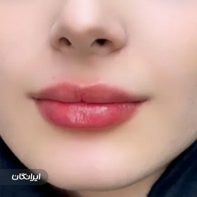 کلینیک زیبایی ایده