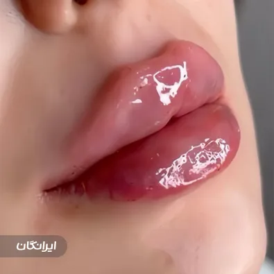 کلینیک زیبایی ایده