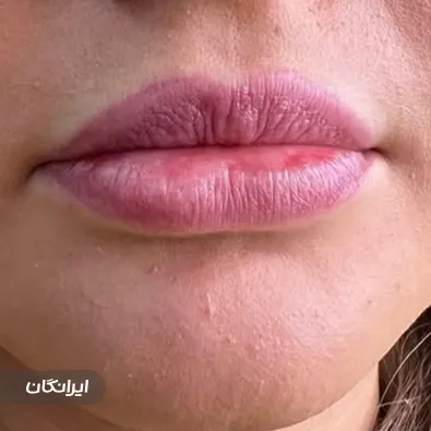 کلینیک زیبایی لاوین