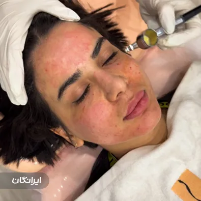 کلینیک زیبایی پیور