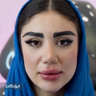 کلینیک زیبایی سلن