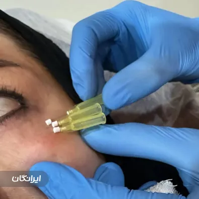 کلینیک زیبایی آی سیما