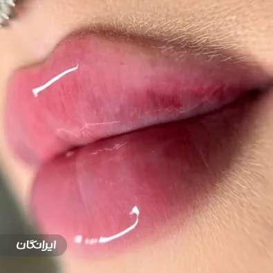 کلینیک زیبایی لیارا