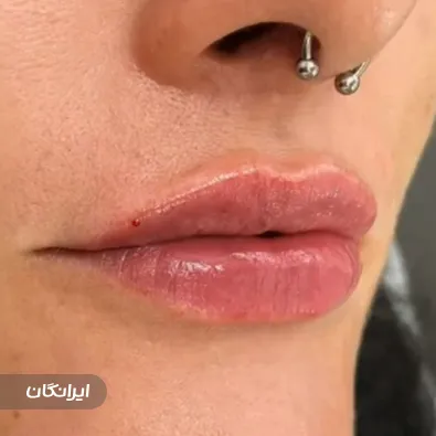 کلینیک زیبایی آتیه