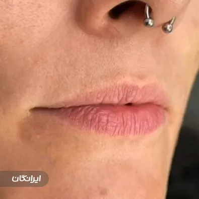 کلینیک زیبایی آتیه