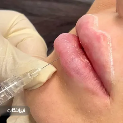 کلینیک زیبایی نوید