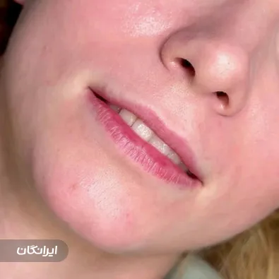 کلینیک زیبایی نوترسا