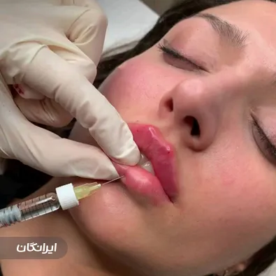 کلینیک زیبایی نوترسا