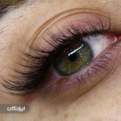 سالن زیبایی آرشیدا