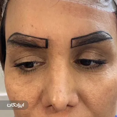 کلینیک زیبایی و لیزر جلفا