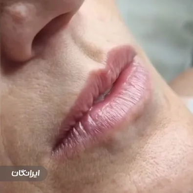 کلینیک زیبایی دکتر زهرا سادات رسولی