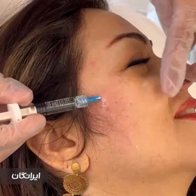 کلینیک زیبایی نیلین