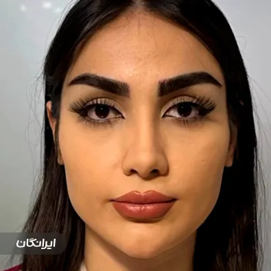 کلینیک زیبایی برنا