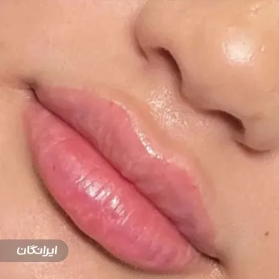 کلینیک زیبایی نیکسا