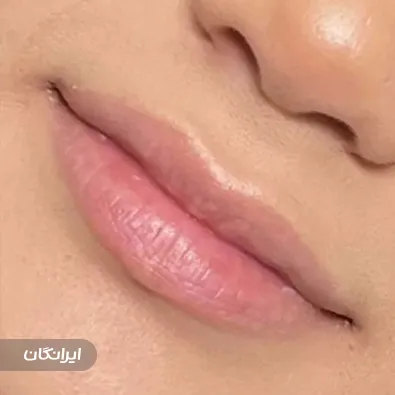 کلینیک زیبایی نیکسا