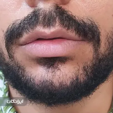 کلینیک زیبایی دکتر ابوالقاسم مهرور