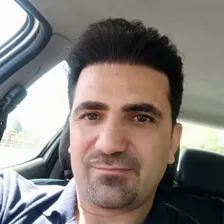 کلینیک کاشت مو شقاقی