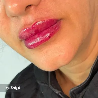 کلینیک زیبایی ماری