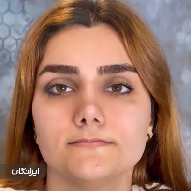 کلینیک زیبایی تاوا