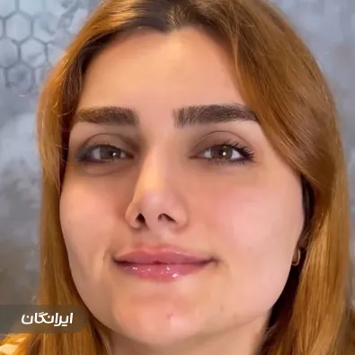 کلینیک زیبایی تاوا