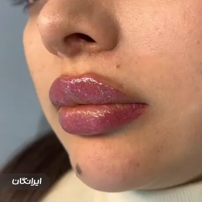 کلینیک زیبایی آتوسا