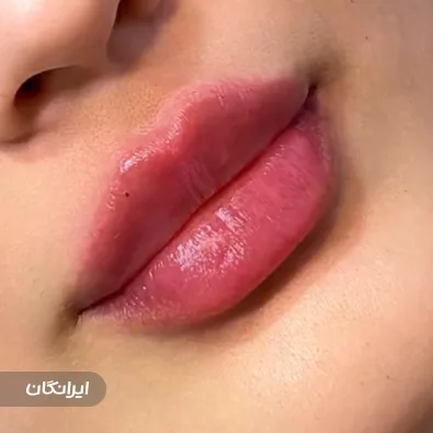 کلینیک زیبایی آتوسا