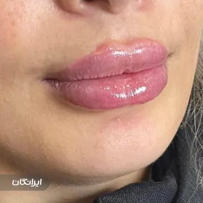 کلینیک زیبایی دکتر نگار داداش پور