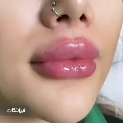 کلینیک زیبایی دکتر نگار داداش پور