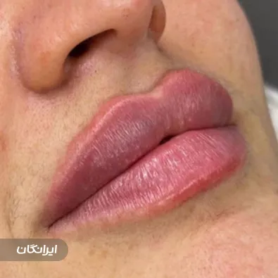 کلینیک زیبایی دیاموند